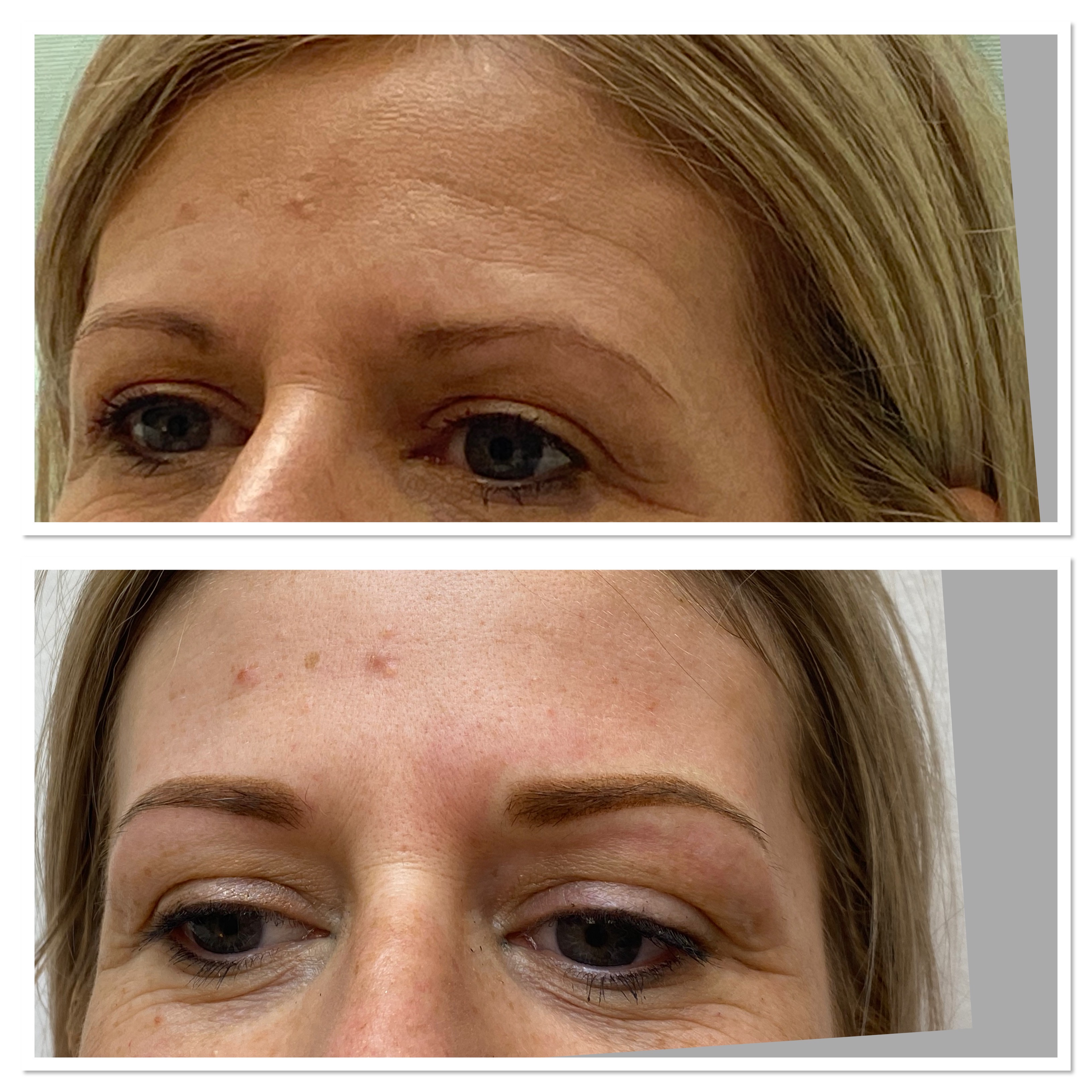 Permanent Make-up der Augenbrauen