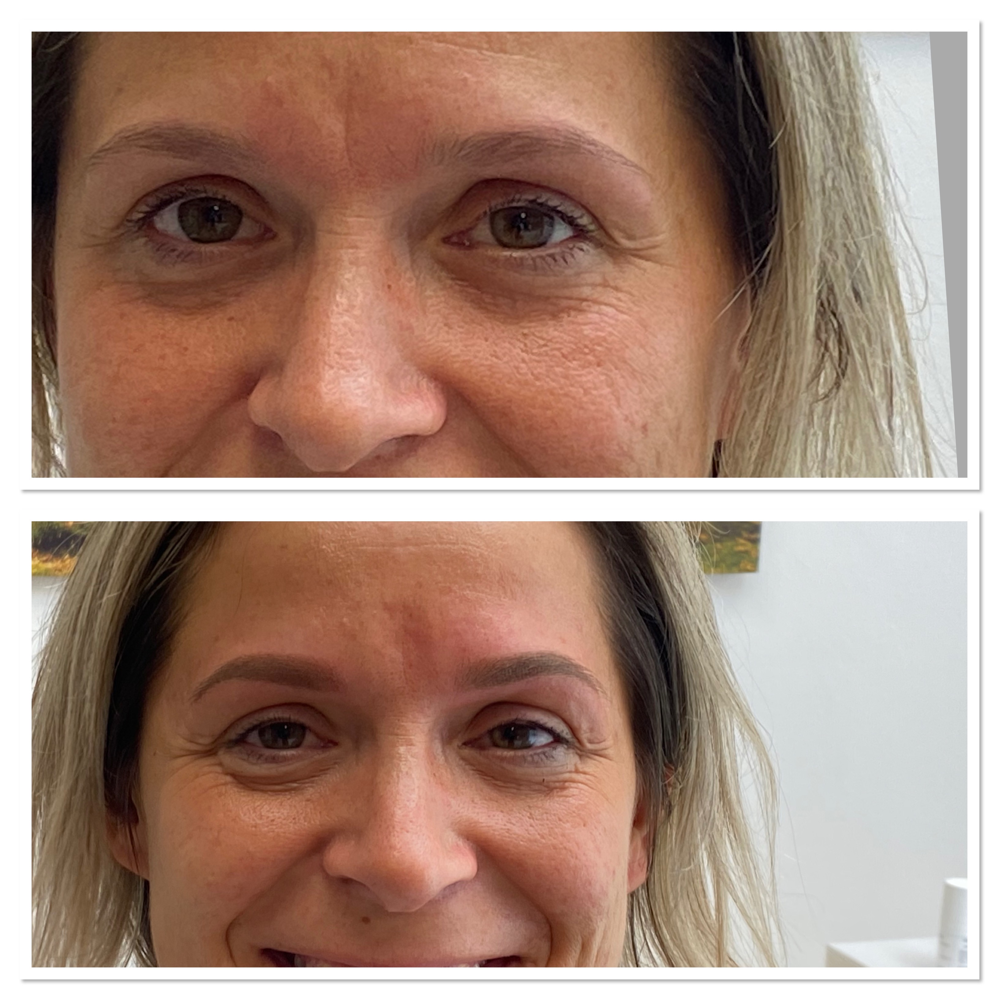 Permanent Make-up der Augenbrauen