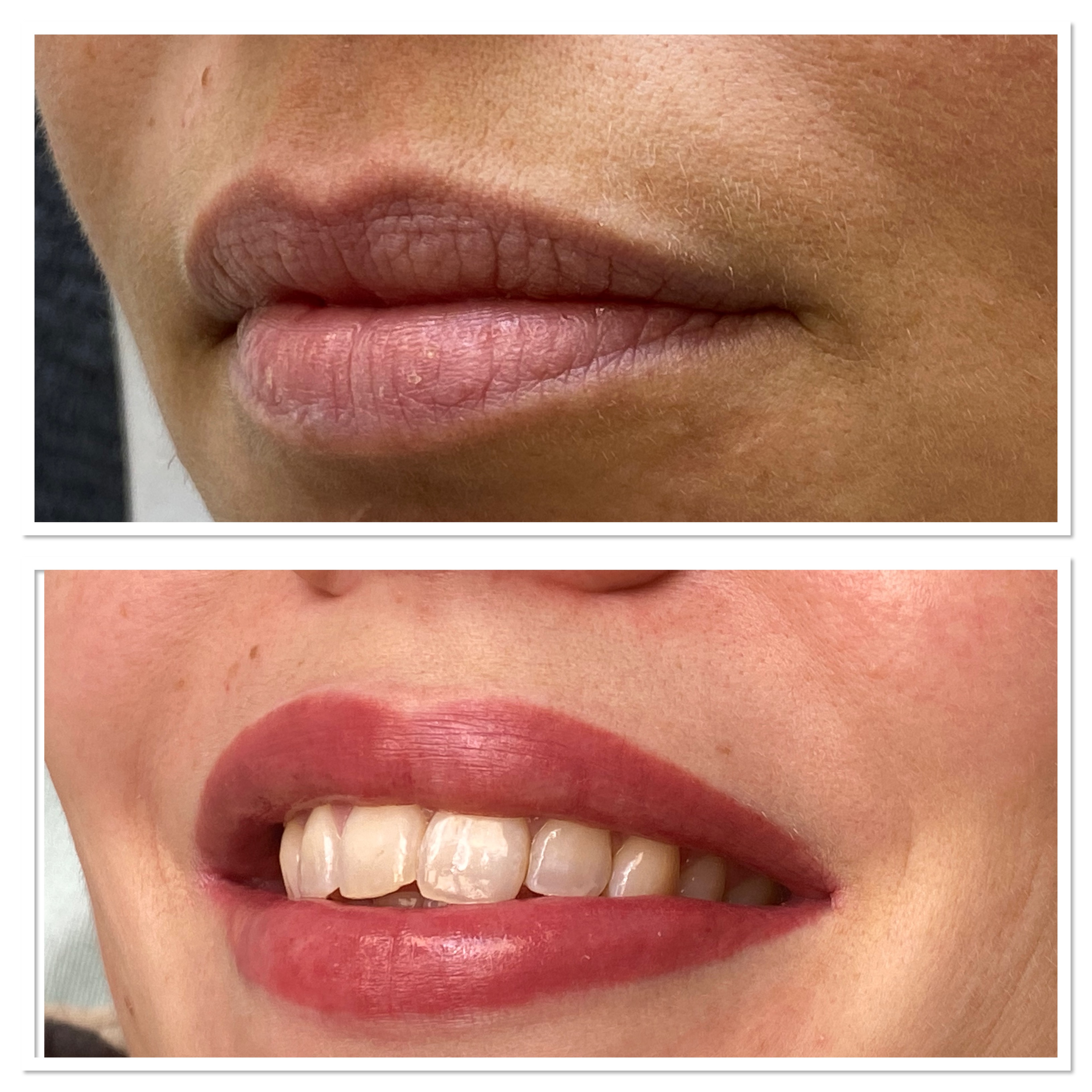 Permanent Makeup Der Lippen