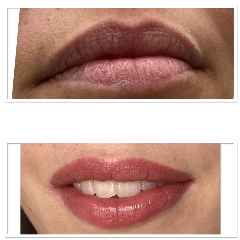 Permanent Makeup der Lippen - vorher/nachher
